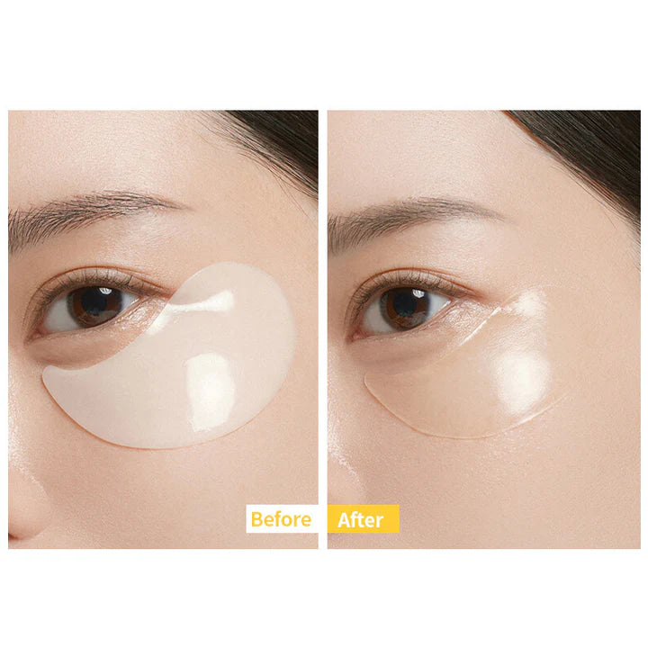 Medianswer Vita Collagen Eye Cream Patch