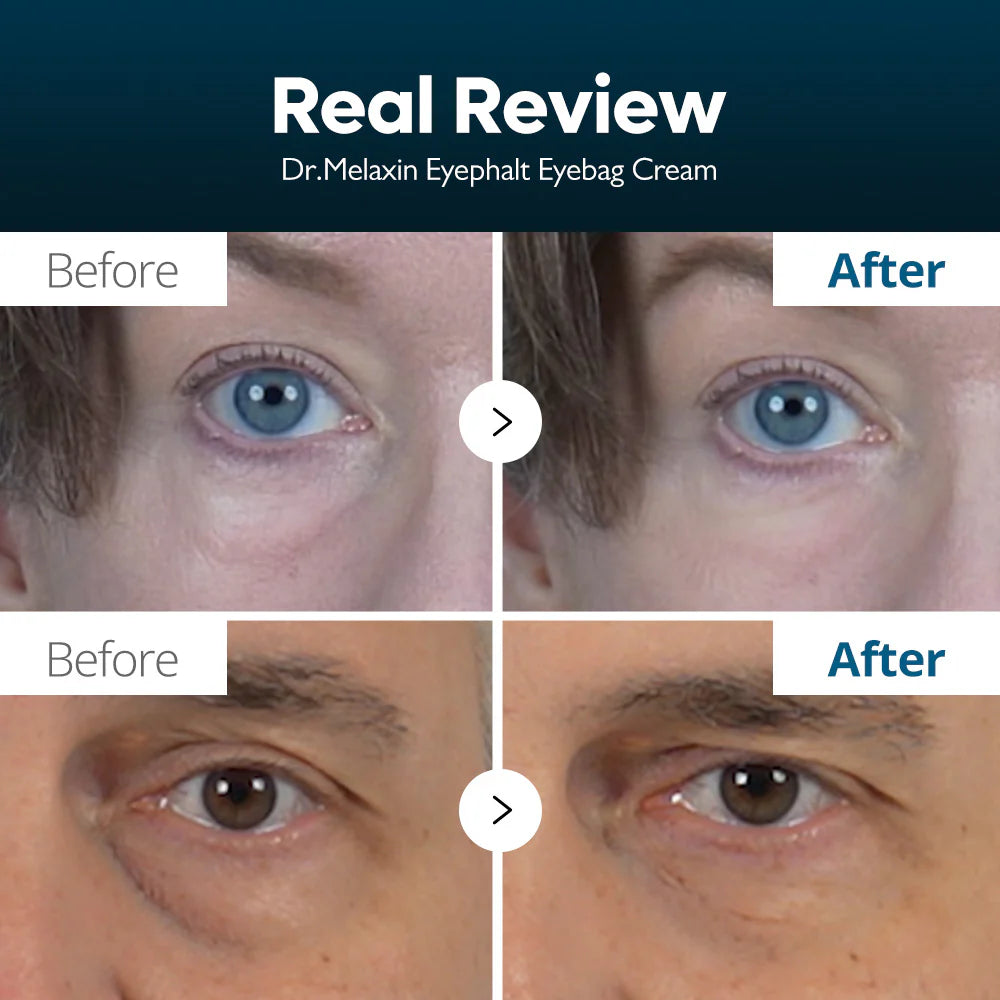 DR.MELAXIN Eyephalt Eyebag Cream